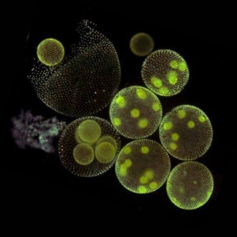 image of green cells against a black background, through a microscope 